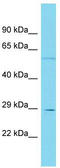 Eukaryotic Elongation Factor 2 Lysine Methyltransferase antibody, TA335333, Origene, Western Blot image 