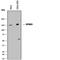 Serine protease inhibitor Kazal-type 5 antibody, AF8515, R&D Systems, Western Blot image 