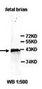 Acyl-CoA Thioesterase 7 antibody, orb77409, Biorbyt, Western Blot image 
