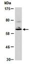 C-C Motif Chemokine Receptor 1 antibody, orb67197, Biorbyt, Western Blot image 