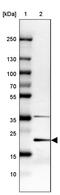 Telomerase RNA Component Interacting RNase antibody, PA5-63805, Invitrogen Antibodies, Western Blot image 