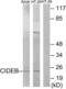 Cell Death Inducing DFFA Like Effector B antibody, LS-C119539, Lifespan Biosciences, Western Blot image 