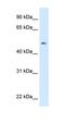 Linker For Activation Of T Cells Family Member 2 antibody, orb325374, Biorbyt, Western Blot image 