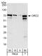 Origin Recognition Complex Subunit 2 antibody, A302-735A, Bethyl Labs, Western Blot image 