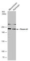 Plexin A1 antibody, GTX133240, GeneTex, Western Blot image 