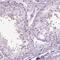 Zinc Finger C2HC-Type Containing 1C antibody, NBP2-62647, Novus Biologicals, Immunohistochemistry paraffin image 