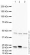 Aquaporin 4 antibody, ab46182, Abcam, Western Blot image 