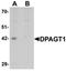 Dolichyl-Phosphate N-Acetylglucosaminephosphotransferase 1 antibody, orb75661, Biorbyt, Western Blot image 