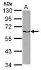p68 antibody, LS-C155422, Lifespan Biosciences, Western Blot image 