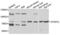 Very long-chain specific acyl-CoA dehydrogenase, mitochondrial antibody, LS-C409413, Lifespan Biosciences, Western Blot image 