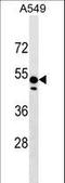 Zinc Finger Protein 695 antibody, LS-C157492, Lifespan Biosciences, Western Blot image 