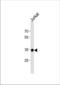 SRY-Box 18 antibody, TA324592, Origene, Western Blot image 