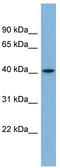 Serpin Family I Member 1 antibody, TA342233, Origene, Western Blot image 