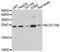 Biogenesis Of Lysosomal Organelles Complex 1 Subunit 6 antibody, STJ25026, St John