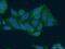 Mitochondrial Ribosomal Protein S16 antibody, 16735-1-AP, Proteintech Group, Immunofluorescence image 