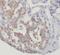 RB Binding Protein 9, Serine Hydrolase antibody, FNab07155, FineTest, Immunohistochemistry frozen image 