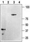 Purinergic Receptor P2Y12 antibody, TA328648, Origene, Western Blot image 