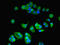 ATPase H+ Transporting V1 Subunit F antibody, LS-C285568, Lifespan Biosciences, Immunofluorescence image 