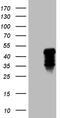 C-Type Lectin Domain Family 4 Member M antibody, M02814-1, Boster Biological Technology, Western Blot image 