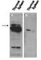 Pogo transposable element with ZNF domain antibody, GTX48710, GeneTex, Western Blot image 