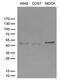 Signal Regulatory Protein Beta 1 antibody, M08437, Boster Biological Technology, Western Blot image 