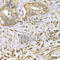 Fascin Actin-Bundling Protein 1 antibody, A1904, ABclonal Technology, Immunohistochemistry paraffin image 