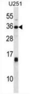 Stanniocalcin 1 antibody, AP54070PU-N, Origene, Western Blot image 