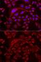 Tu Translation Elongation Factor, Mitochondrial antibody, GTX55825, GeneTex, Immunocytochemistry image 
