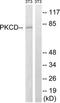 Protein kinase C delta type antibody, TA312516, Origene, Western Blot image 