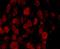 Neurotrophic Receptor Tyrosine Kinase 3 antibody, NB100-98829, Novus Biologicals, Immunocytochemistry image 