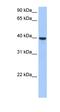 ST6 N-Acetylgalactosaminide Alpha-2,6-Sialyltransferase 4 antibody, orb325444, Biorbyt, Western Blot image 