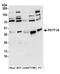 Choline-phosphate cytidylyltransferase A antibody, A304-558A, Bethyl Labs, Western Blot image 