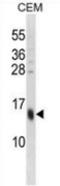 Small Proline Rich Protein 3 antibody, AP54035PU-N, Origene, Western Blot image 