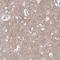 Synaptoporin antibody, NBP2-38932, Novus Biologicals, Immunohistochemistry frozen image 