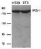 Insulin Receptor Substrate 1 antibody, AP02733PU-N, Origene, Western Blot image 