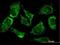 Monoacylglycerol O-Acyltransferase 3 antibody, H00346606-M05, Novus Biologicals, Immunofluorescence image 