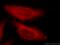 Serologically defined colon cancer antigen 3 antibody, 15969-1-AP, Proteintech Group, Immunofluorescence image 