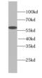 Sep (O-Phosphoserine) TRNA:Sec (Selenocysteine) TRNA Synthase antibody, FNab07899, FineTest, Western Blot image 