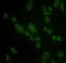 Glucosylceramidase Beta antibody, ab55080, Abcam, Immunocytochemistry image 