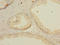 Ligand of Numb protein X 2 antibody, A67038-100, Epigentek, Immunohistochemistry paraffin image 