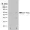 Chaperonin Containing TCP1 Subunit 8 antibody, NB100-66596, Novus Biologicals, Western Blot image 