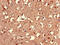 Probable lysosomal cobalamin transporter antibody, LS-C398030, Lifespan Biosciences, Immunohistochemistry paraffin image 