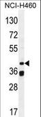BSCL2 Lipid Droplet Biogenesis Associated, Seipin antibody, LS-C156867, Lifespan Biosciences, Western Blot image 