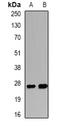 Ccn5 antibody, orb341303, Biorbyt, Western Blot image 