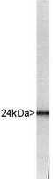 Ubiquitin C-Terminal Hydrolase L1 antibody, TA336533, Origene, Western Blot image 