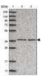 Chromosome 3 Open Reading Frame 38 antibody, PA5-57039, Invitrogen Antibodies, Western Blot image 