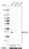 Heat Shock Protein Family B (Small) Member 8 antibody, NBP1-84945, Novus Biologicals, Western Blot image 