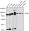 SUMO Specific Peptidase 1 antibody, GTX66159, GeneTex, Western Blot image 