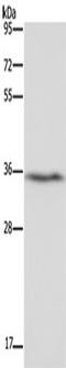 Dimethylarginine Dimethylaminohydrolase 1 antibody, TA350909, Origene, Western Blot image 
