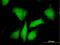 PKA regulatory subunit I beta antibody, H00005575-B01P, Novus Biologicals, Immunocytochemistry image 